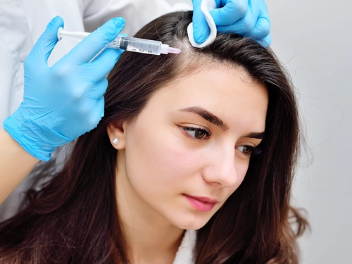 Exosomale Behandlung für Haarausfall Erläutert