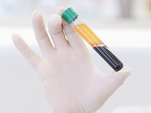 PRP